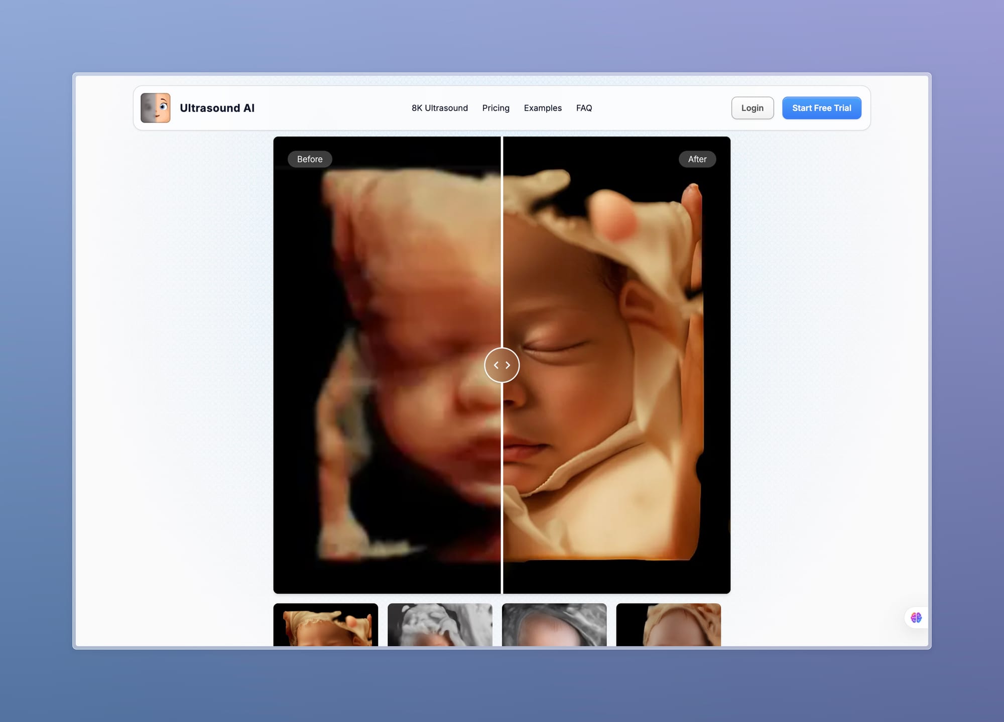 Realistic Baby Photo AI from Ultrasound